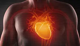 ACC 2024 - EMPACT-MI - Empagliflozina após infarto agudo do miocárdio